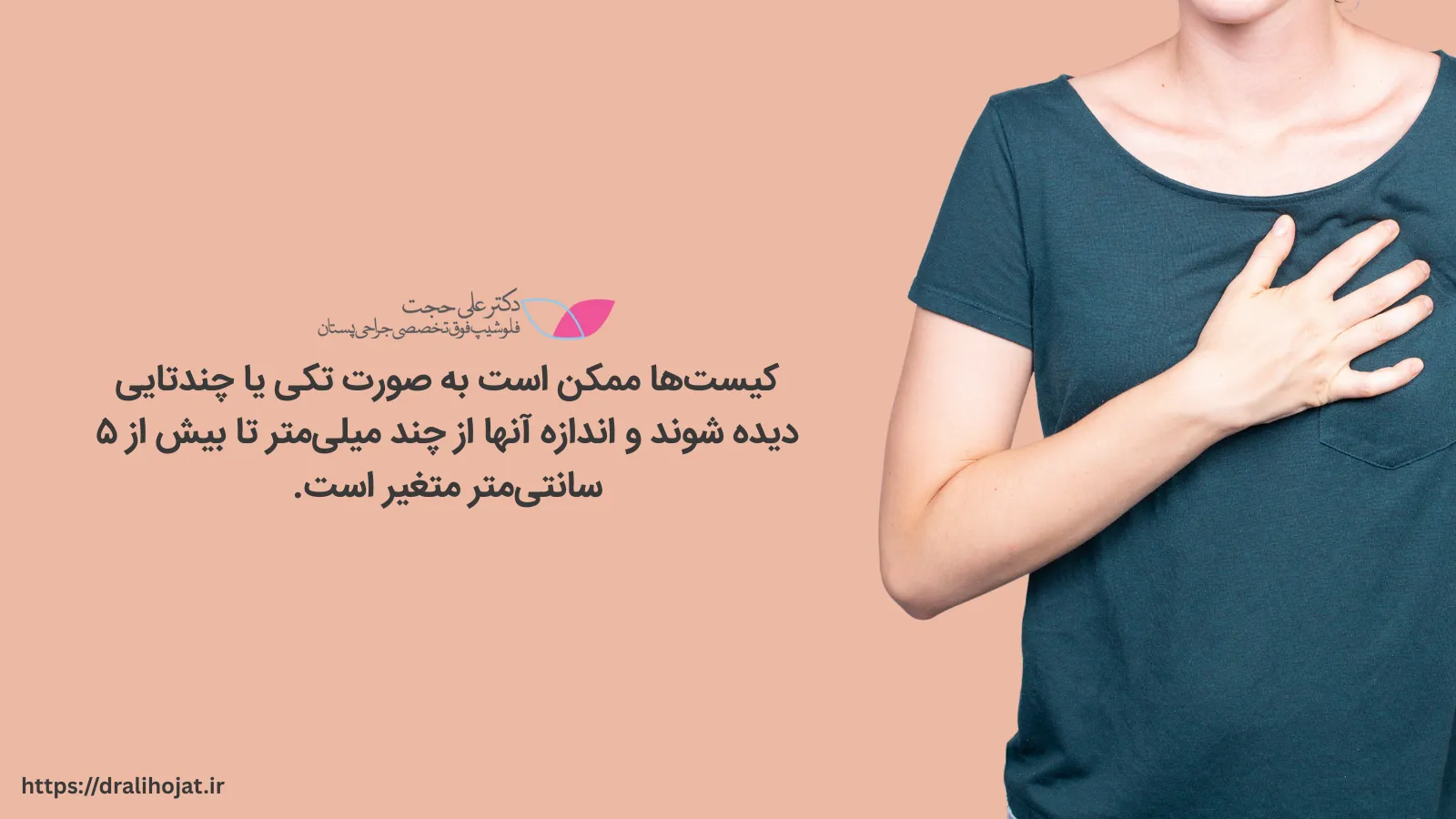 اندازه کیست سینه